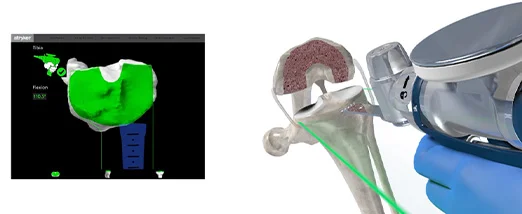 Haptic feedback - Safe Orthopedic Robotic Surgery