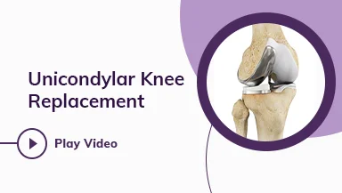 Orthopedic Robotic Partial Knee Replacement Surgery