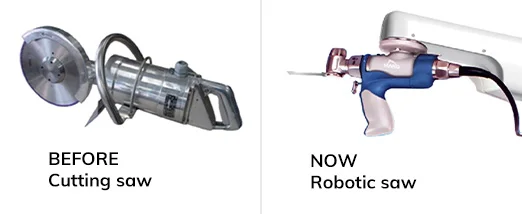 Orthopedic Saw for Joint Replacement Surgery
