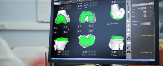 Best precision with Orthopedic Robotic Surgery
