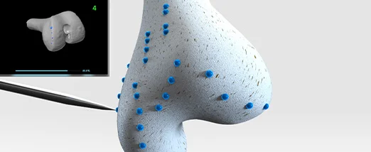 Unmatched 3D mapping technology for Orthopedic Robotic Surgery