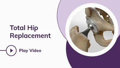 Orthopedic Robotic Total Hip Replacement Surgery